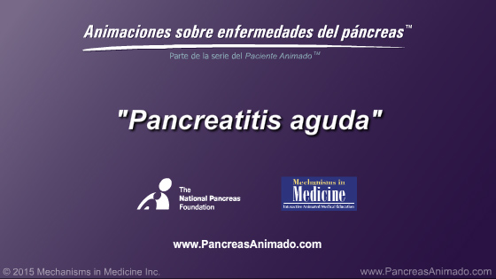 Pancreatitis aguda - Slide Show - 2